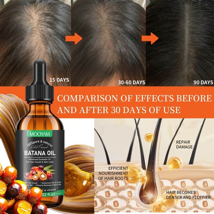 Rediscover Your Hair’s Natural Strength With MOOYAM Batana Oil high quality